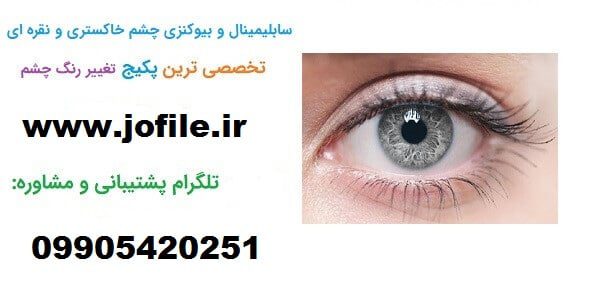 سابلیمینال چشم نقره ای جدیدترین نسخه 1405 1 سابلیمینال چشم نقره ای